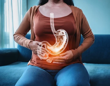 Transoral Incisionless Fundoplication (TIF) GANJ
