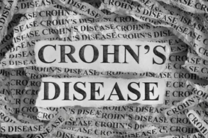 Crohns-Disease-square