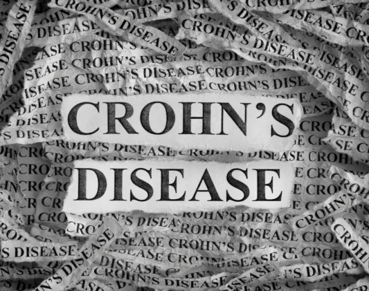 Crohns Disease square Crohns Disease square