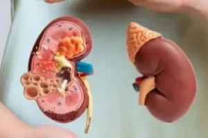 GANJ-kidney-gut-square